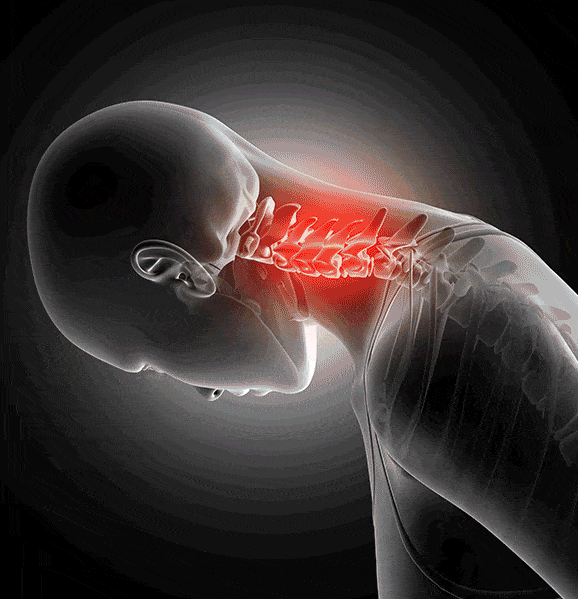 cervical pillow, ergonomic neck pillow, memory foam cervical pillow, orthopaedic cervical pillow, contour neck pillow for side sleepers, best cervical pillow for neck pain
